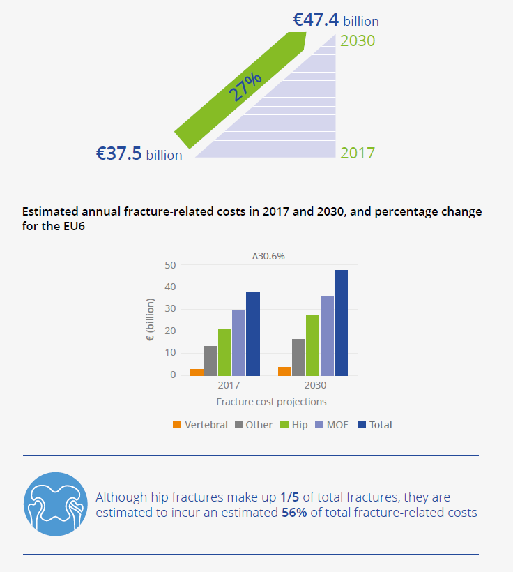 Proiezione dei costi per la gestione delle fratture dal 2017 al 2030