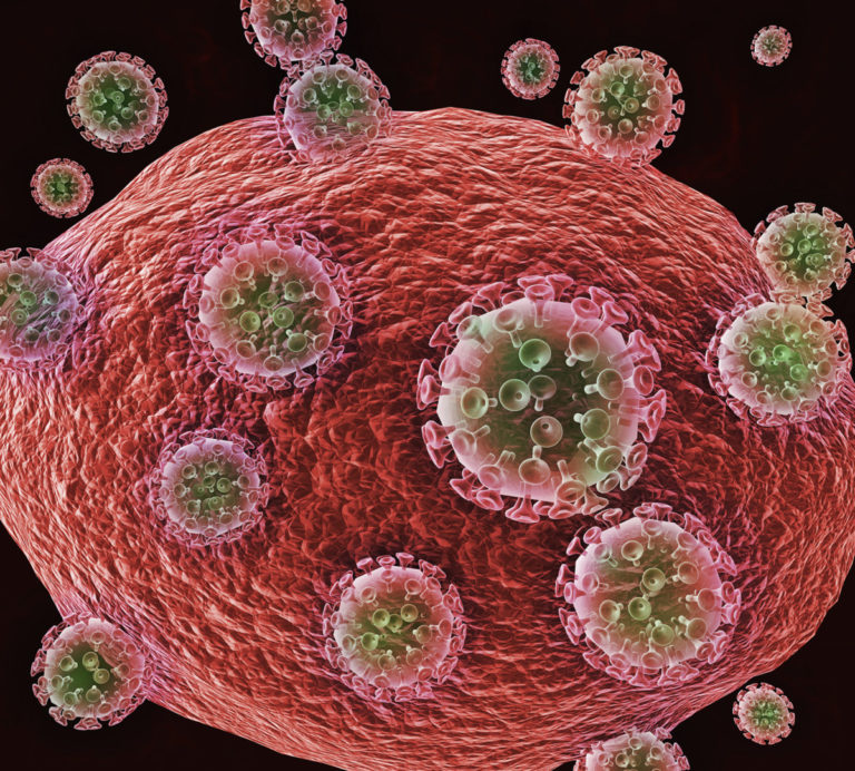 Infezione da HIV: patologia osteo-metabolica e chirurgia implantare