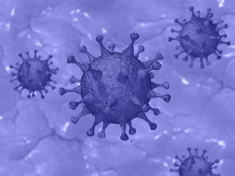 Trattamento della SARS con corticosteroidi e conseguenze ossee a lungo termine