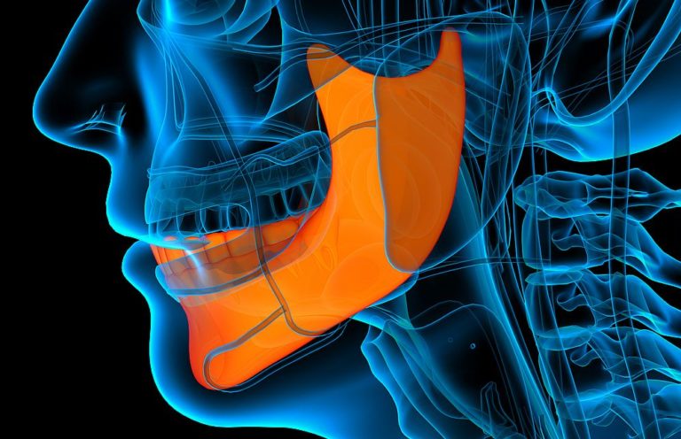 Rischio di osteonecrosi mascellare/mandibolare nei pazienti in terapia con clodronato