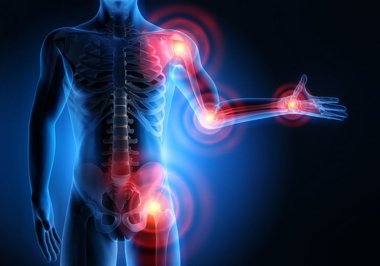 Microbiota intestinale e osteoartrosi, un approccio farmacoeconomico