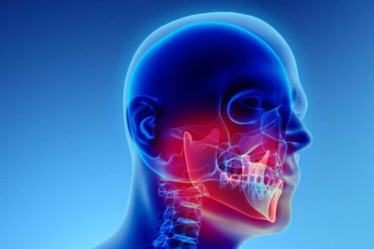 Prevenzione dell’osteonecrosi delle ossa mascellari (ONJ) nei pazienti in terapia anti-riassorbitiva