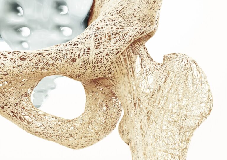 Denosumab: efficacia del trattamento per osteoporosi