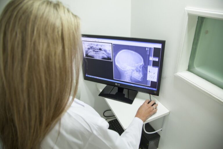 Quanto si sa sull’osteonecrosi dei mascellari legata ai bisfosfonati?