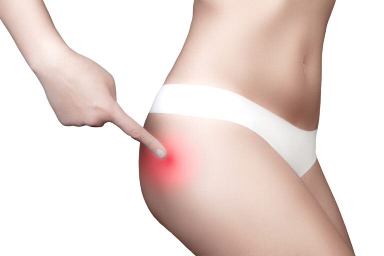 Il neridronato intramuscolo per il trattamento domiciliare della CRPS-1