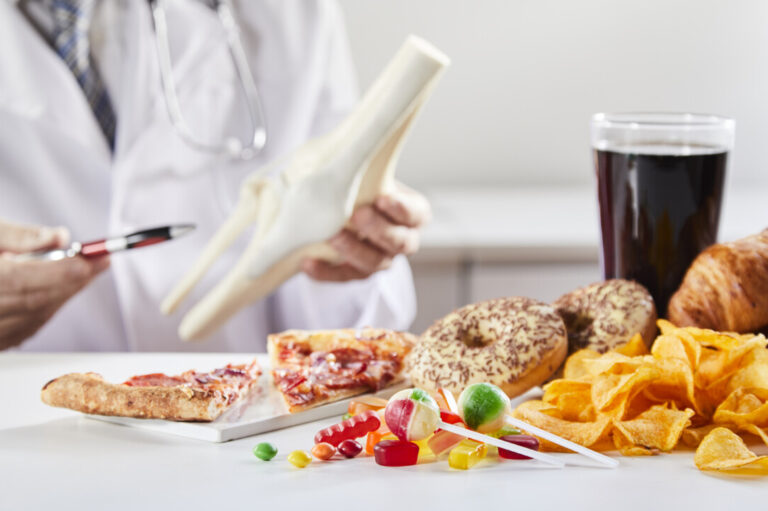 Osteoporosi e diabete: il metabolismo del glucosio nella salute delle ossa