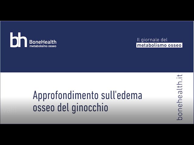 Edema osseo del ginocchio, parla l’esperto