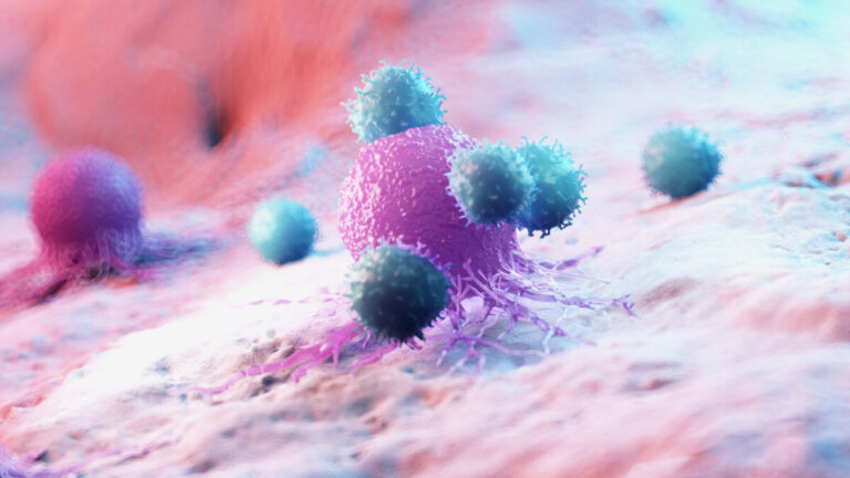 Trattamento del cancro e delle metastasi ossee durante il Covid