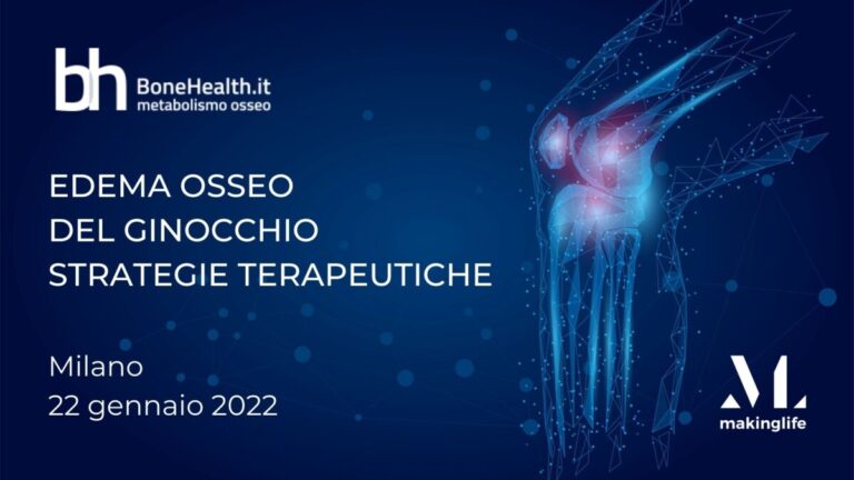 Edema osseo del ginocchio, il video