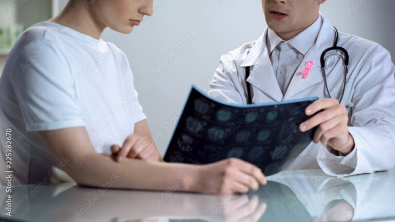 Gestione della CTIBL e blocco ormonale adiuvante nell’early breast cancer