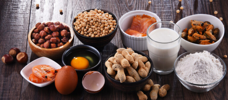 Allergie alimentari e salute delle ossa nei bambini