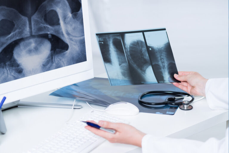 Osteoporosi: l’impegno di Gedeon Richter Italia
