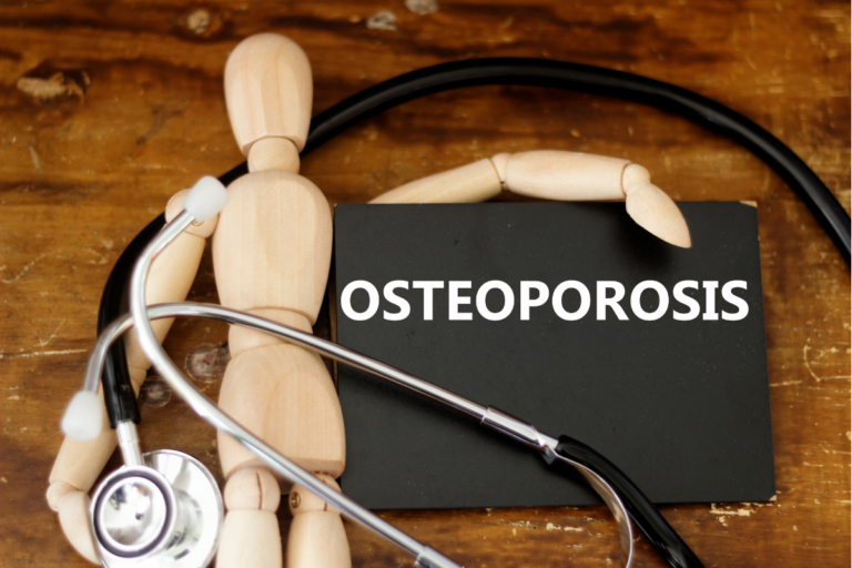 Osteoporosi secondaria