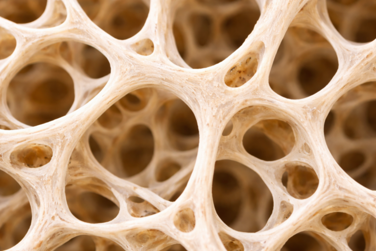 Qualità ossea: il ruolo del D-chiro-inositolo oltre la densità minerale