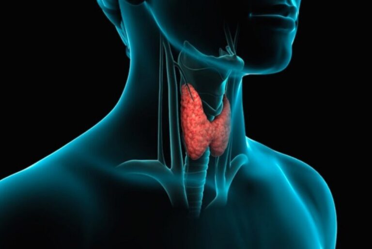 Influenza delle patologie della tiroide sul rischio di fratture da osteoporosi